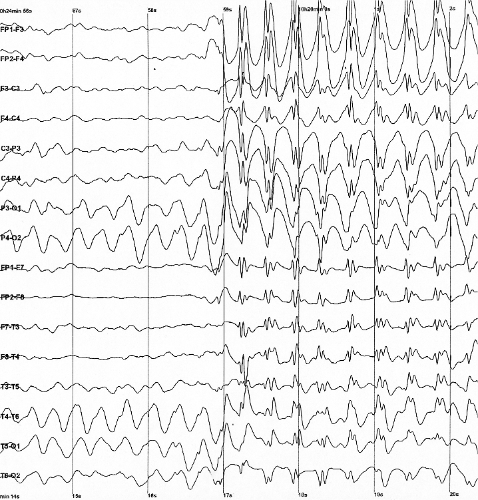 EEG testi